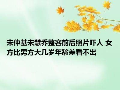 宋仲基宋慧乔整容前后照片吓人 女方比男方大几岁年龄差看不出