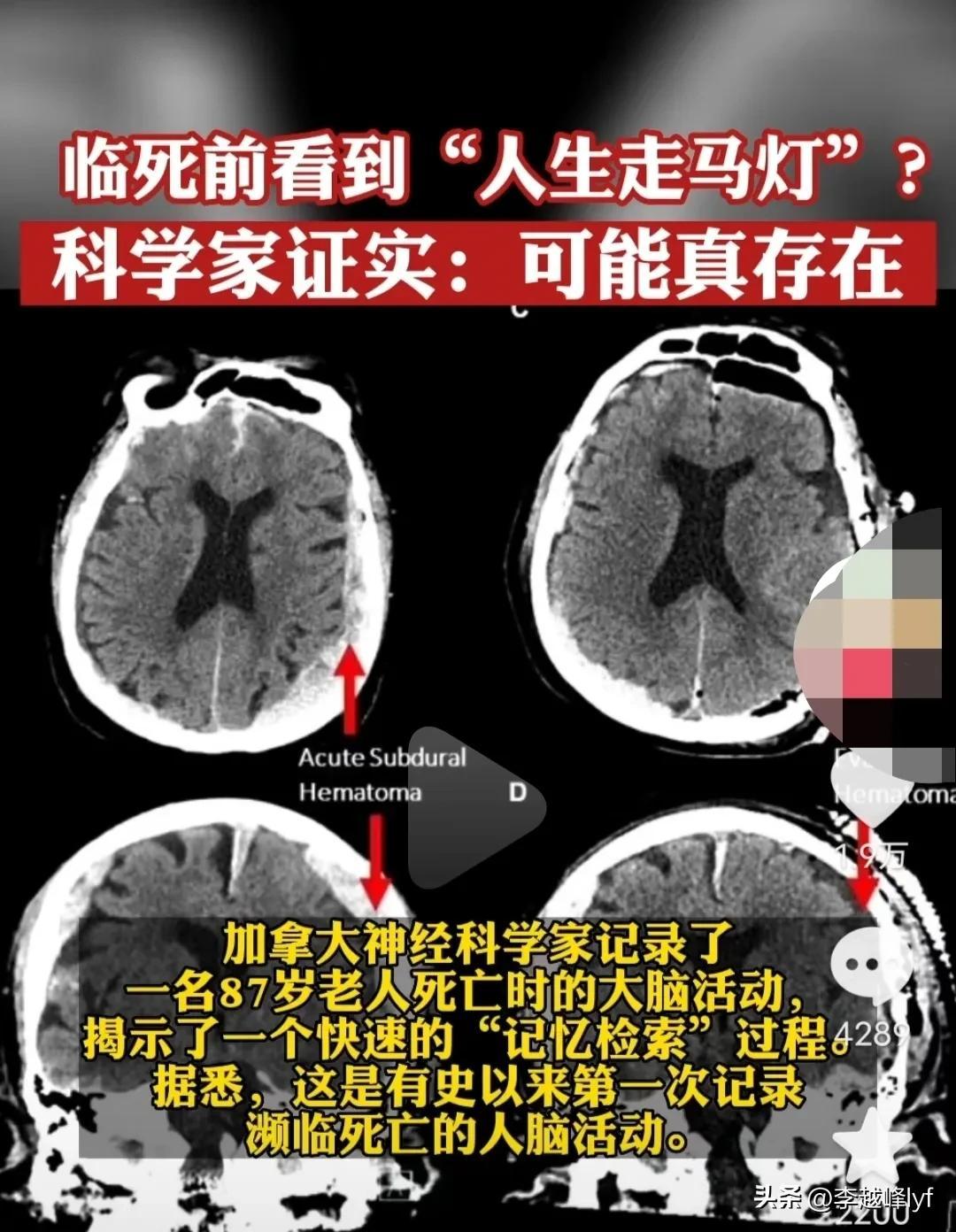 如果人死后真的有走马灯这个环节是什么意思（走马灯是什么意思网络用语）(图3)