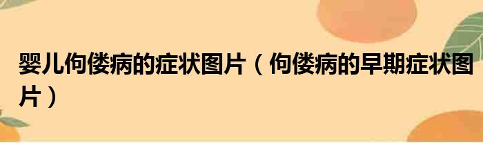 婴儿佝偻病的症状图片（佝偻病的早期症状图片）