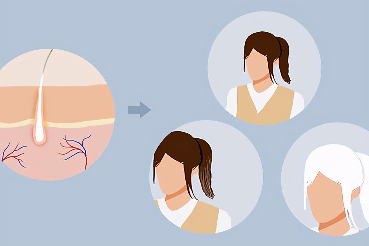 不到60岁头发全白病因（女人多大年龄有白头发算正常）(图2)