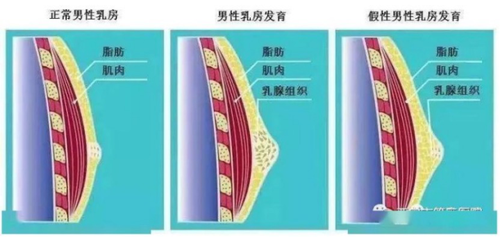 青春期乳房一抓捏里面有硬块(青春期乳房一抓捏里面有硬块会痛乳房一大一小)