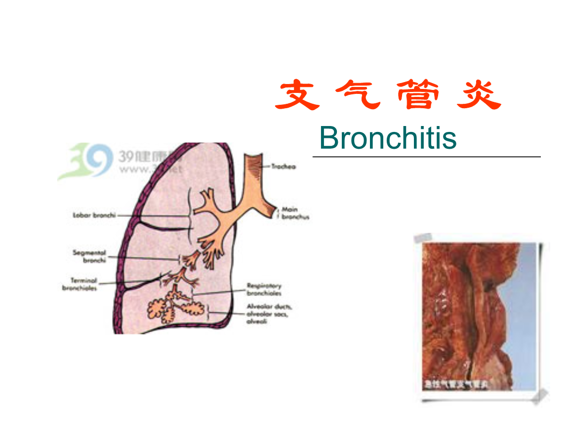 支气管炎的症状(支气管炎的症状都有哪些表现)